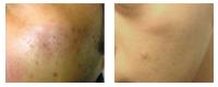 Clear Complexions Skin Therapy image 5